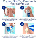 Cryotag Skin Tag Remover - Fast Effective Safe - up to 12 Treatments - Image 3